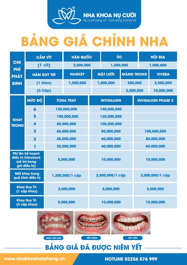 bang-gia-nieng-rang-invisalign- trong-suot-hai-phong