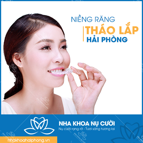 NIỀNG RĂNG THÁO LẮP HẢI PHÒNG