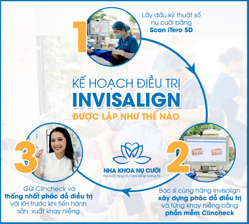 chao-he-ruc-ro-Invisalign