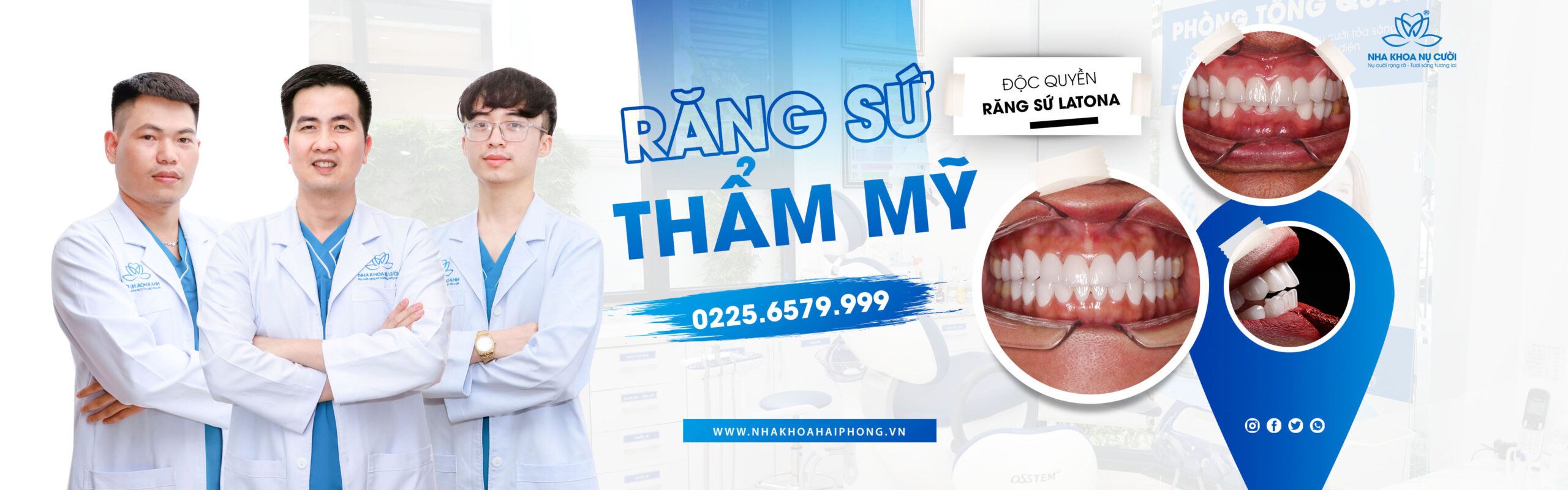 TUỔI THỌ RĂNG SỨ THẨM MỸ KÉO DÀI BAO LÂU