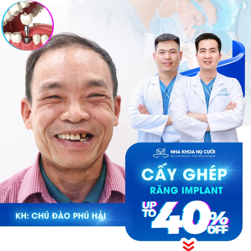 chuong-trinh-uu-dai-cay-ghep-implant