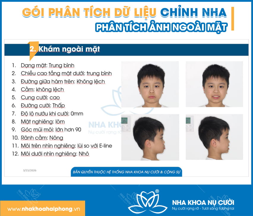 chinh-nha-nieng-rang