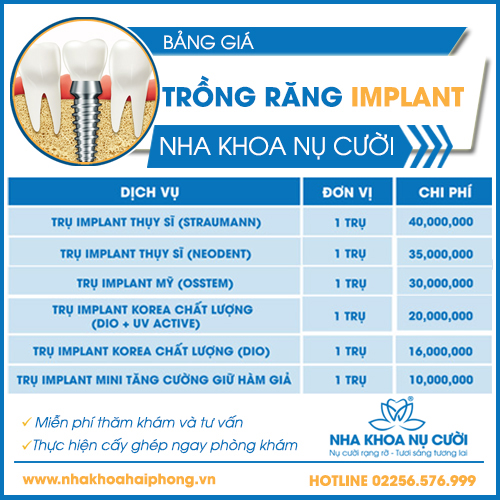 bang-gia-cay-ghep-implant-2022
