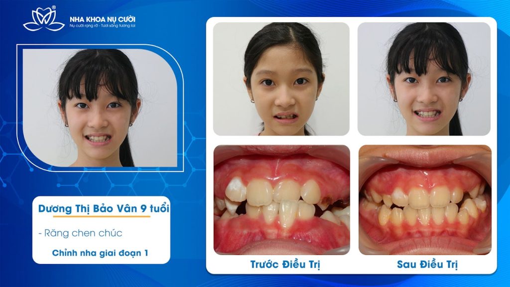 khach-hang-nieng-rang