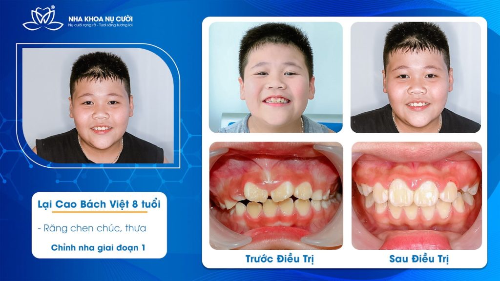 khach-hang-nieng-rang