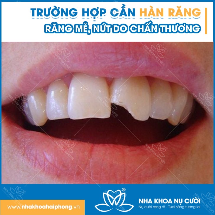truong-hop-can-han-rang