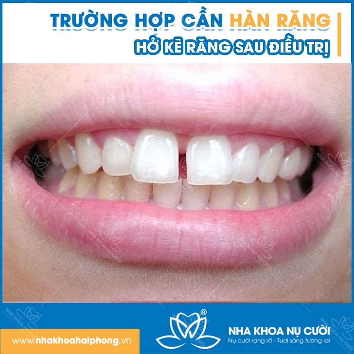 truong-hop-can-han-rang
