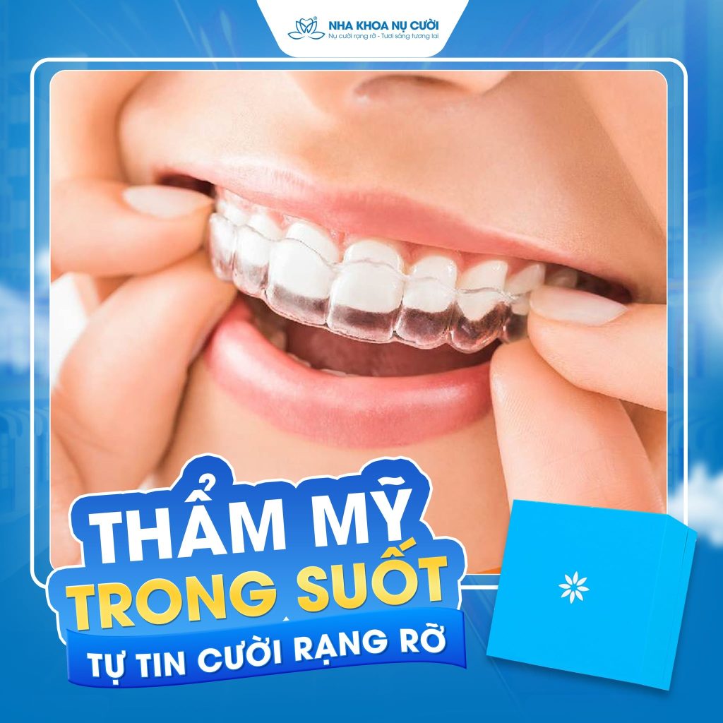 nieng-rang-invisalign