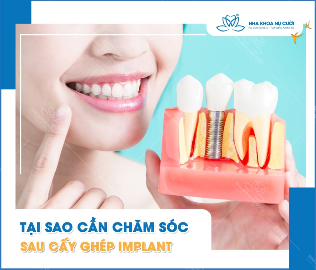 sau-cay-ghep-implant