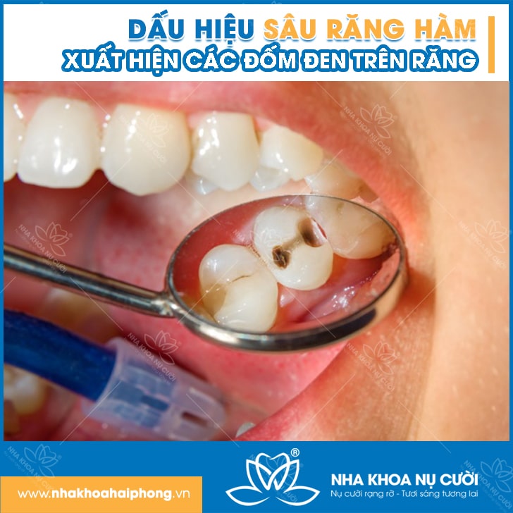 DAU-hieu