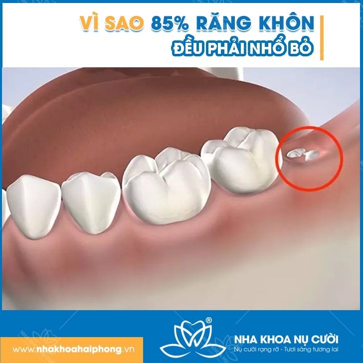 85%-rang-khon