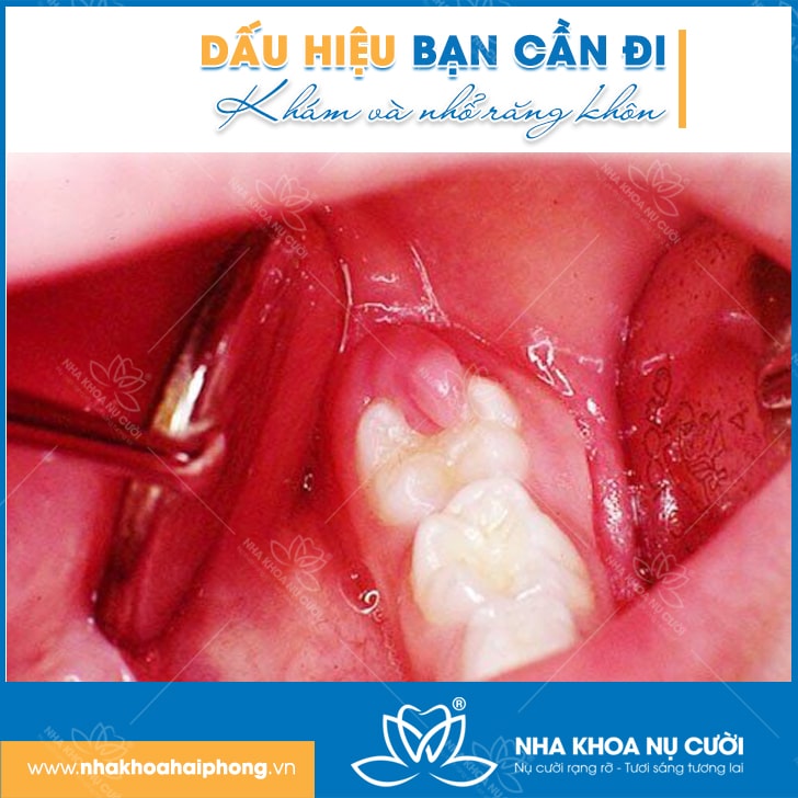 85%-rang-khon