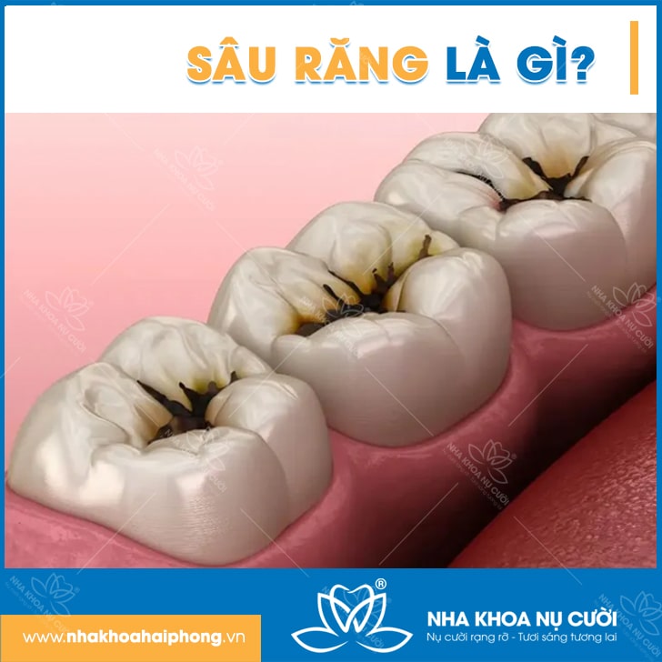 sau-rang
