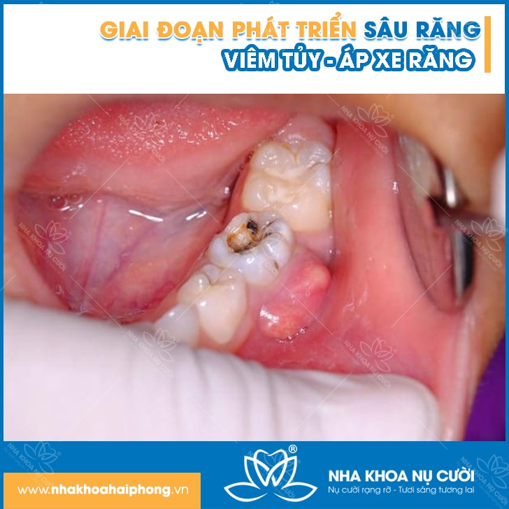 giai-doan