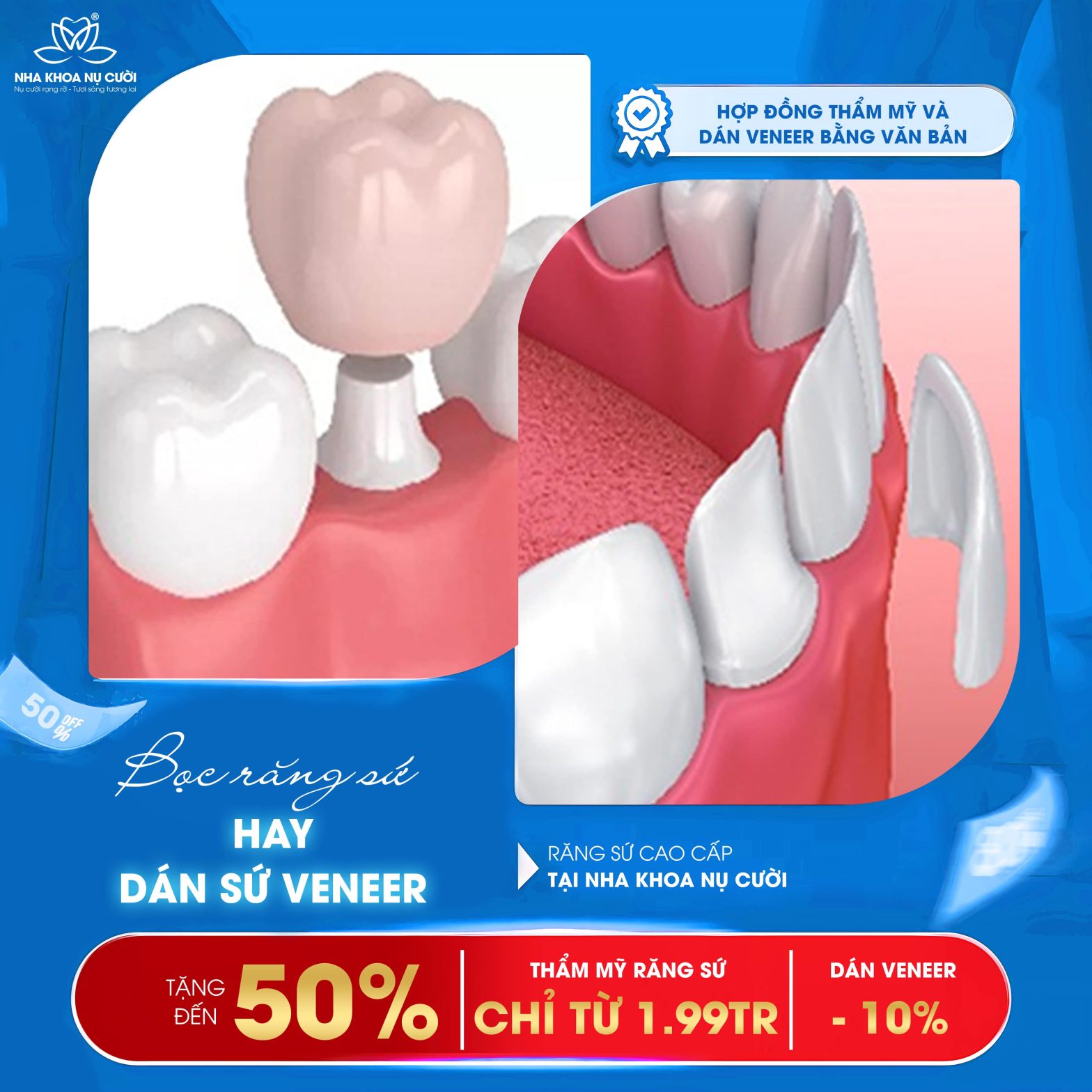 Nên Chọn Bọc Răng Sứ Hay Dán Sứ Veneer?