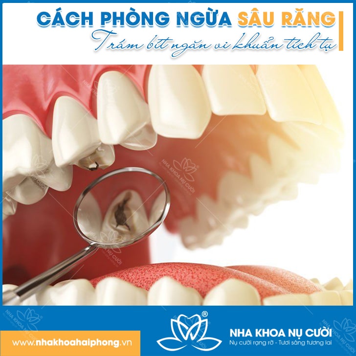 phong-ngua