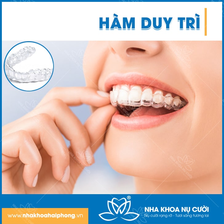 Có Cần Đeo Hàm Duy Trì Sau Niềng Răng Không?