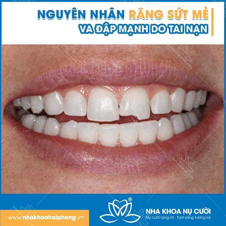 rang-sut-me