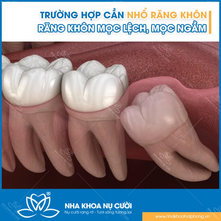 nho-rang-khon
