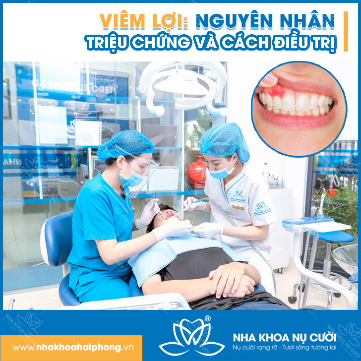 Viêm Lợi: Nguyên Nhân, Triệu Chứng Và Cách Điều Trị 