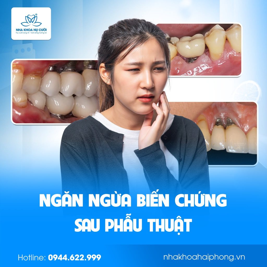 ngan-ngua