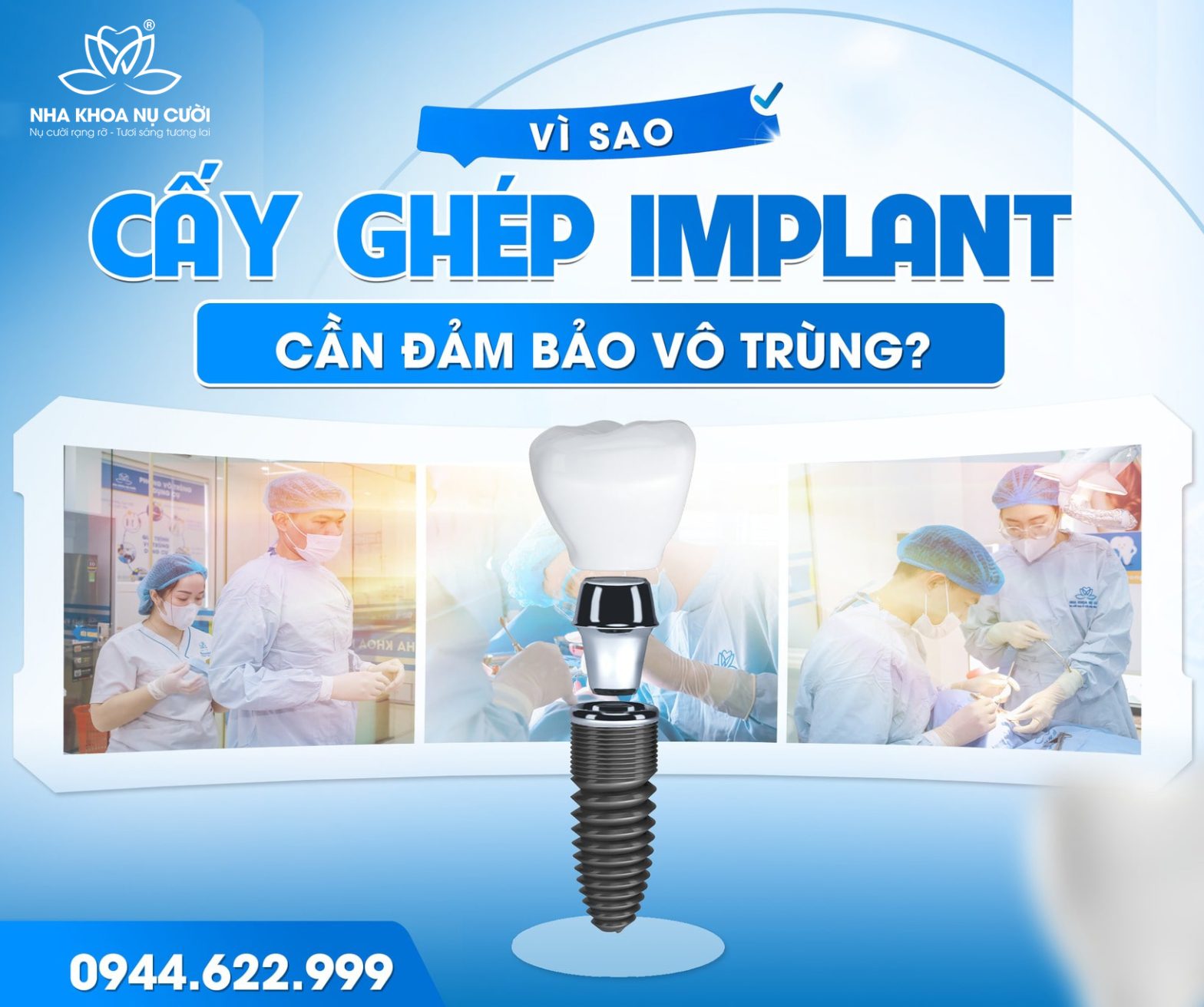 Hệ Thống Vô Trùng Vô Khuẩn Trong Cấy Ghép Implant