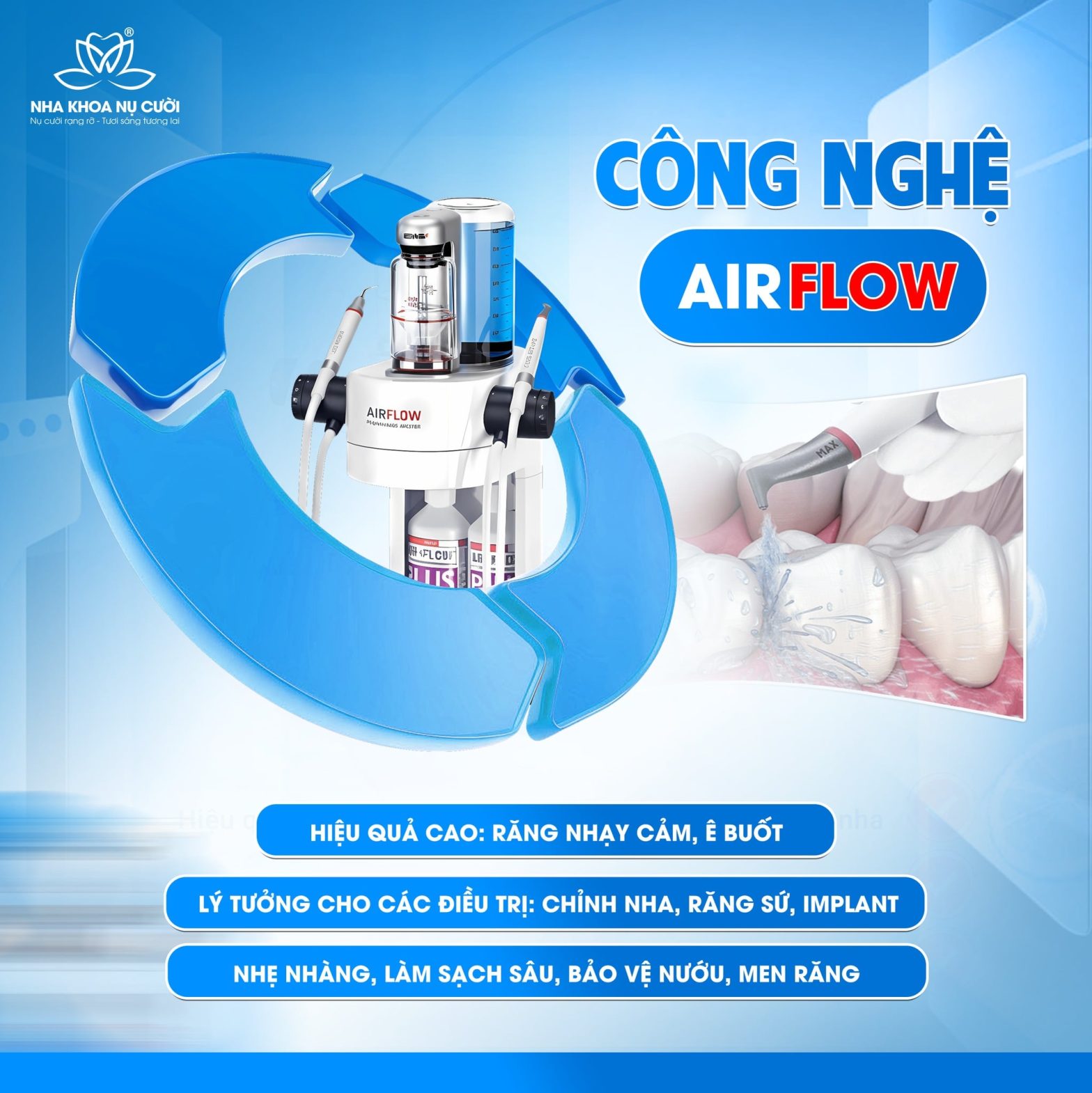 Công nghệ Airflow chuẩn Thụy Sĩ tại Nha Khoa Nụ Cười