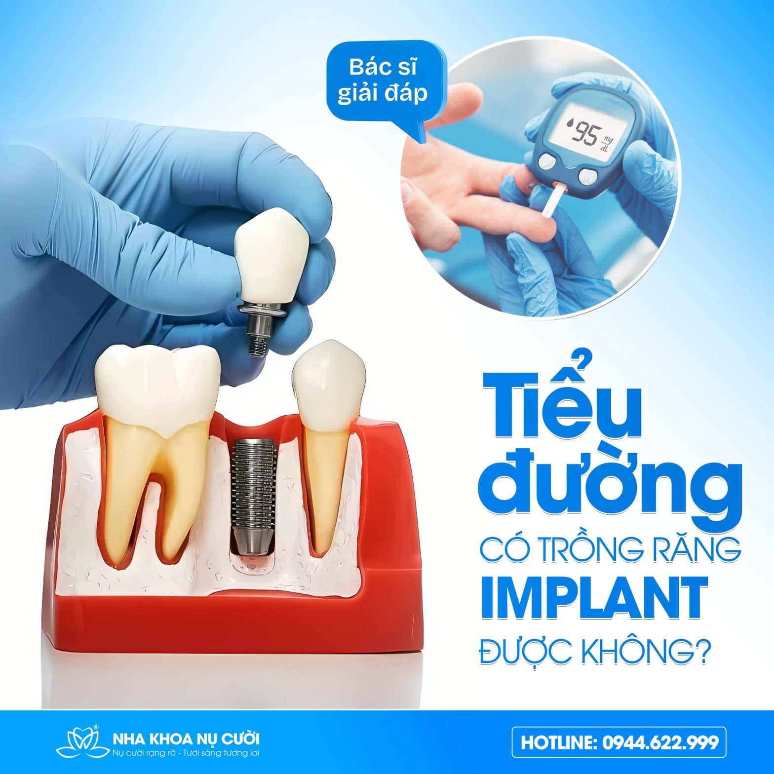 Người Bị Tiểu Đường Có Trồng Răng Implant Được Không?