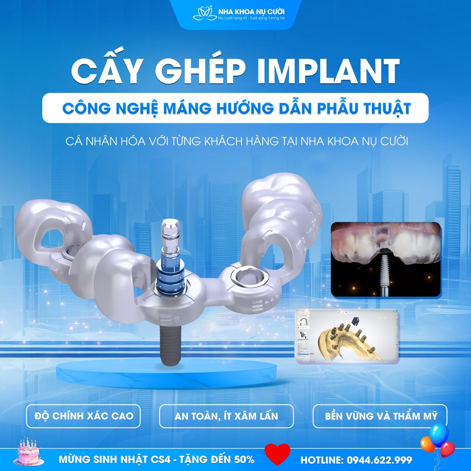 Cấy Ghép Implant Bằng Máng Hướng Dẫn Phẫu Thuật