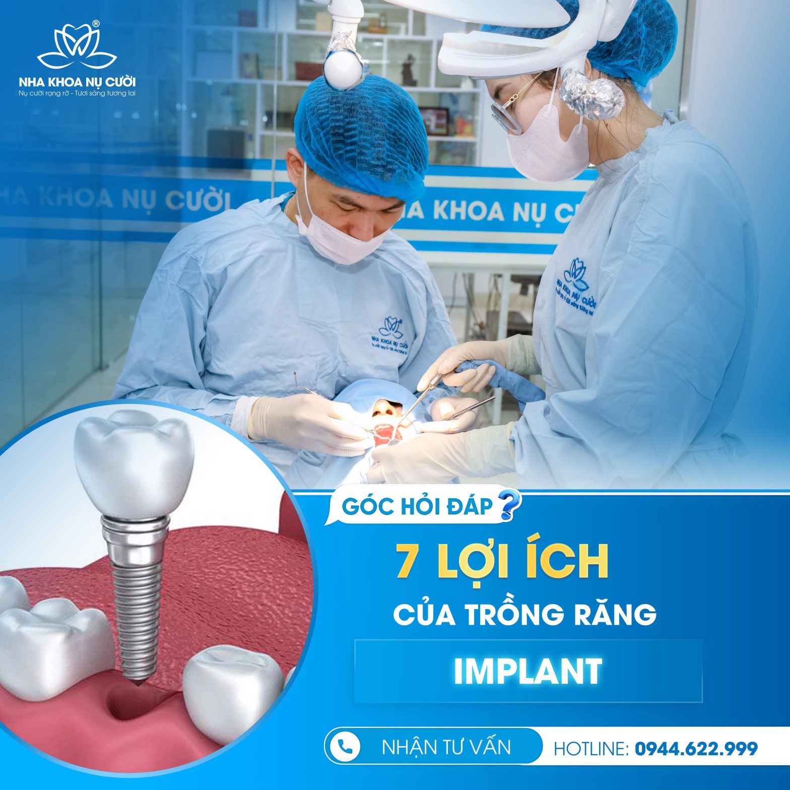 Khám phá 7 lợi ích tuyệt vời của trồng răng Implant