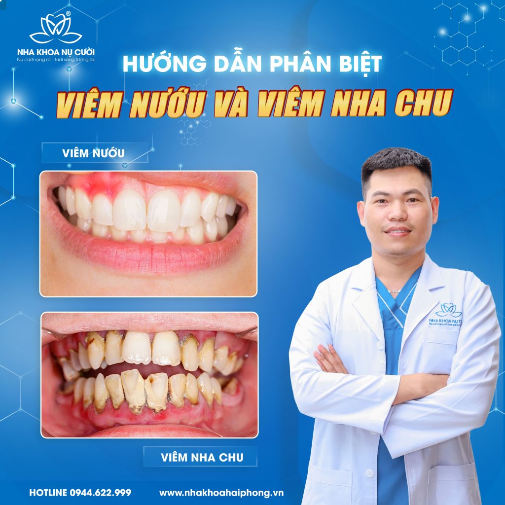 viem-nuou-va-viem-nha-chu