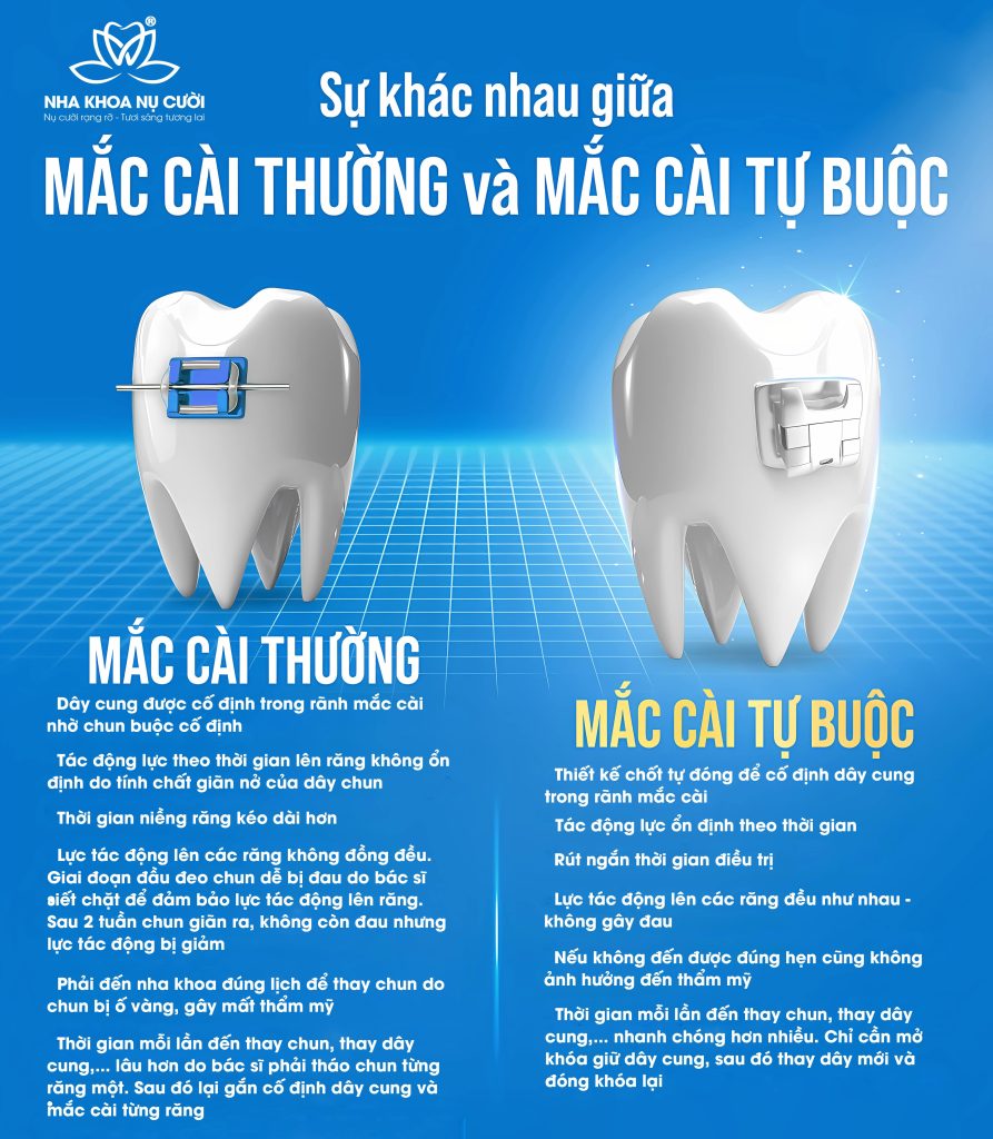 cai-thuong-và-cai-tu-buoc