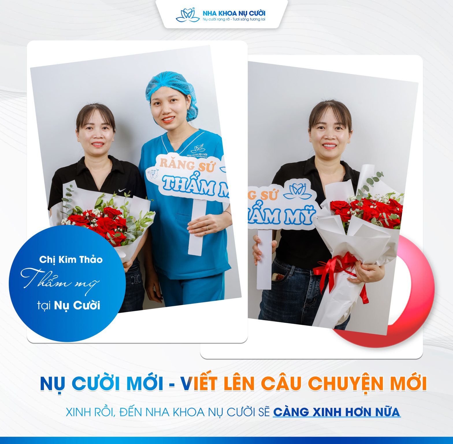 Thẩm Mỹ 20 Răng Sứ Emax Của Chị Kim Thảo