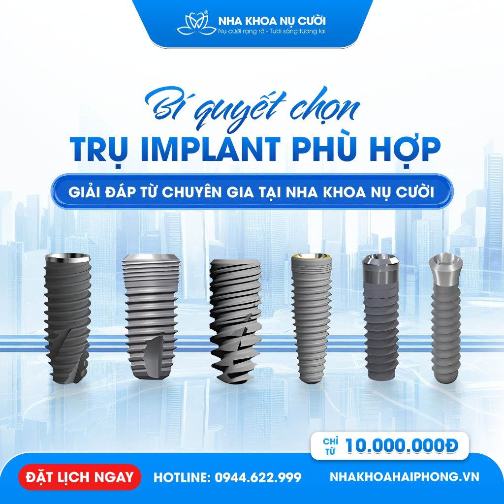 trong-rang-implant-nen-chon-loai-nao