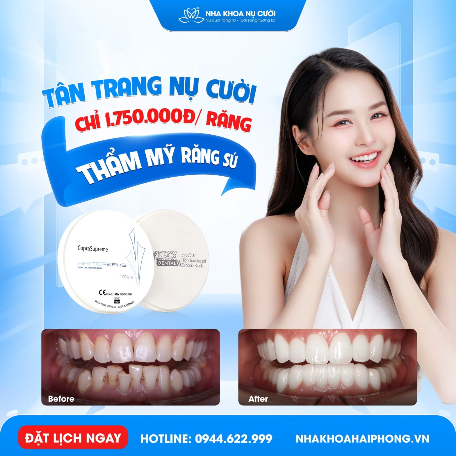 Cận Tết Làm Răng Sứ Nụ Cười Đẹp Đón Xuân