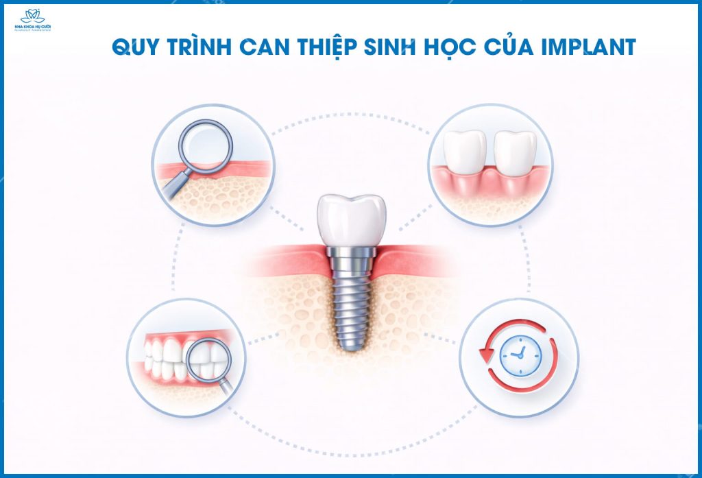 minh-hoa-he-sinh-hoc-implant