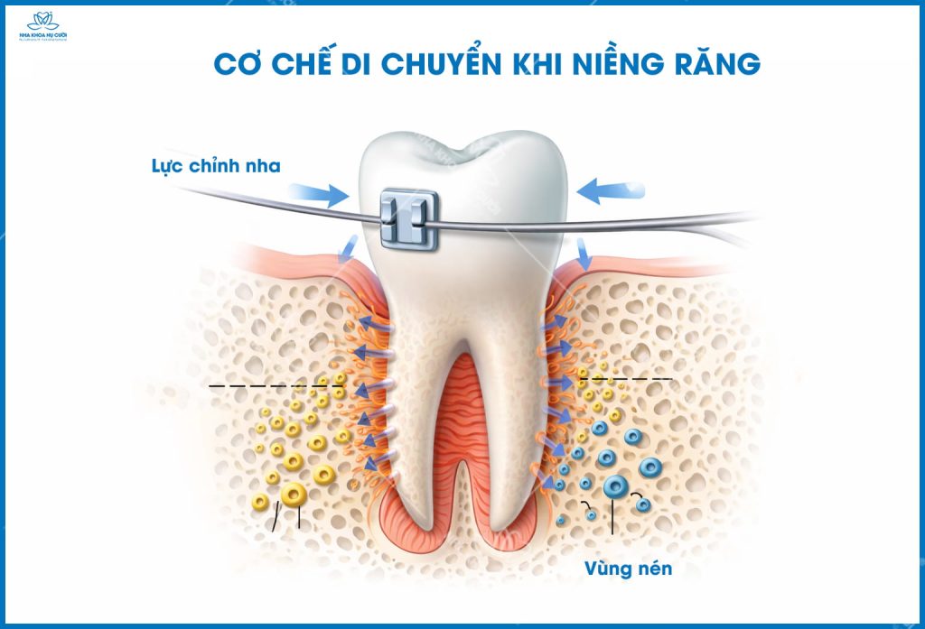 co-che-di-chuyen-rang