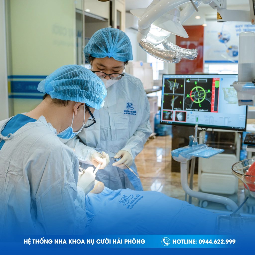 IMPLANT-NHA-KHOA-NU-CUOI