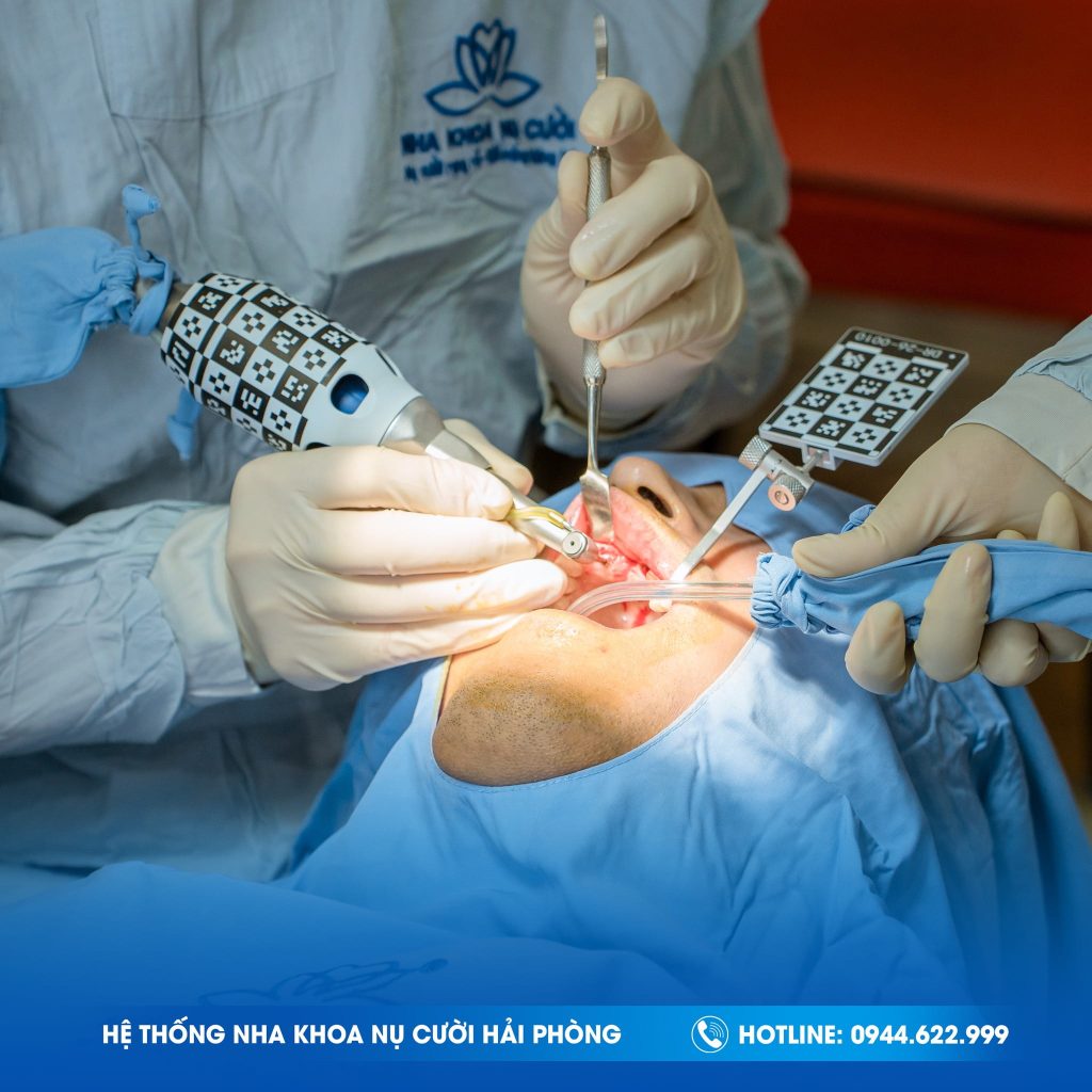 IMPLANT-NHA-KHOA-NU-CUOI