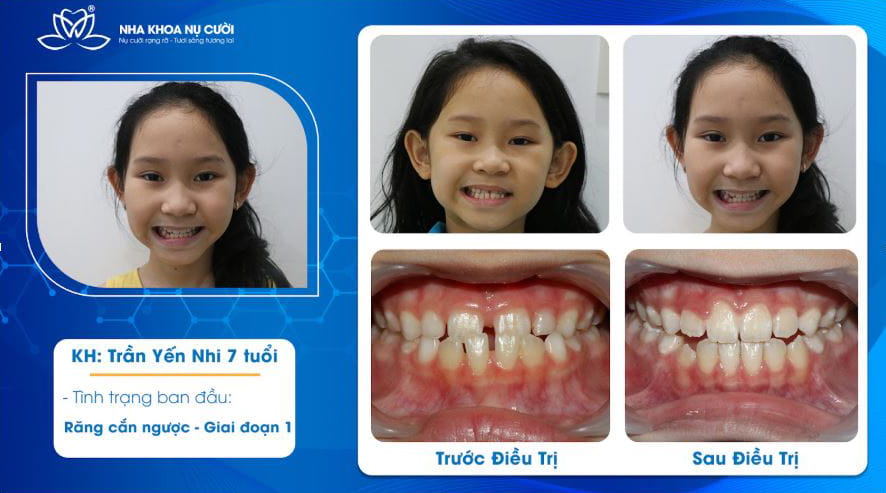 NIENG-RANG-SOM-CHO-TRE