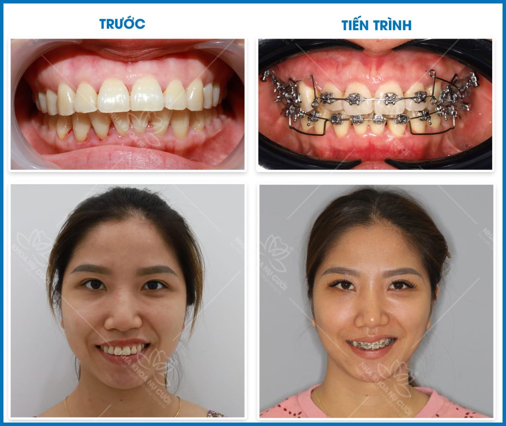 nguoi-truong-thanh-nieng-rang.