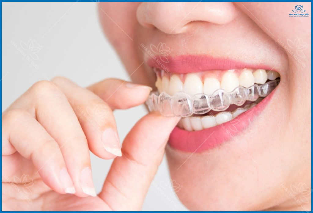 nieng-rang-khay-trong-suot