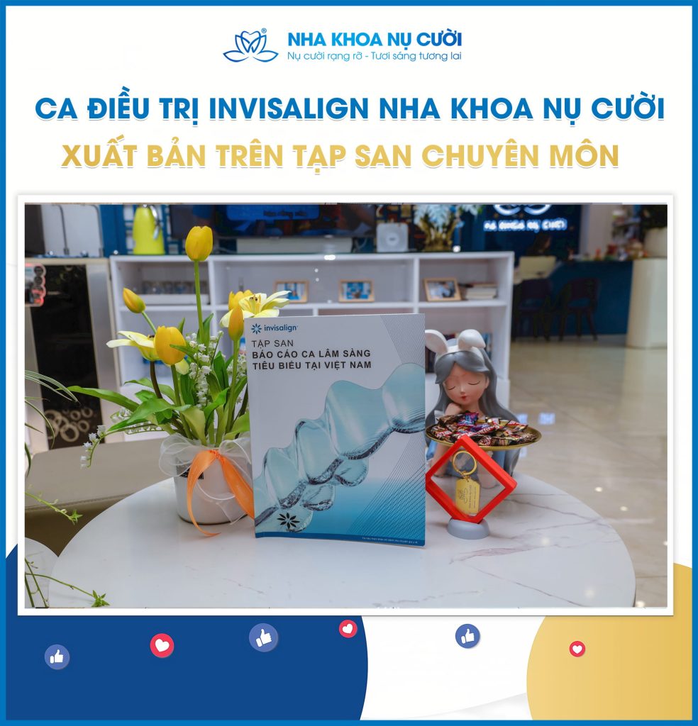 ca-dieu-tri-invisalign