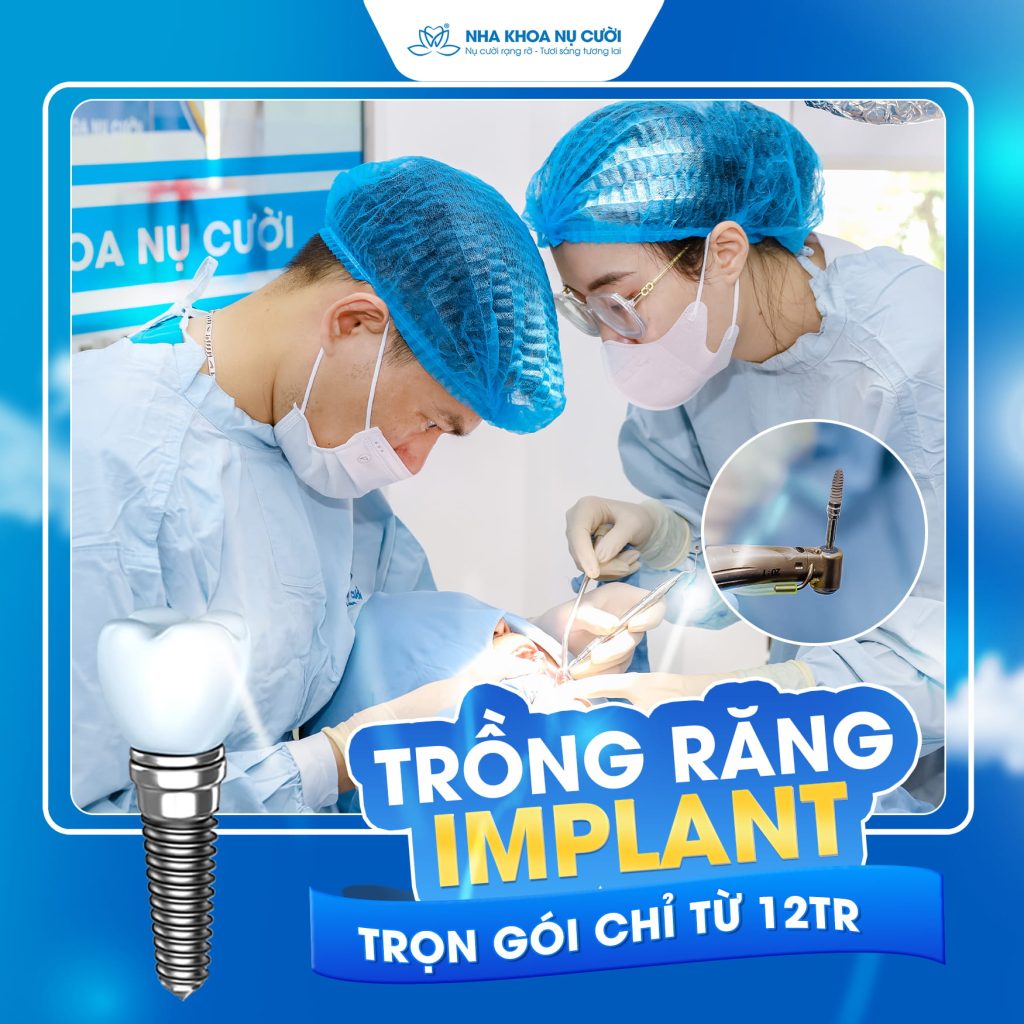 uu-dai-lam-rang-tai-cs4