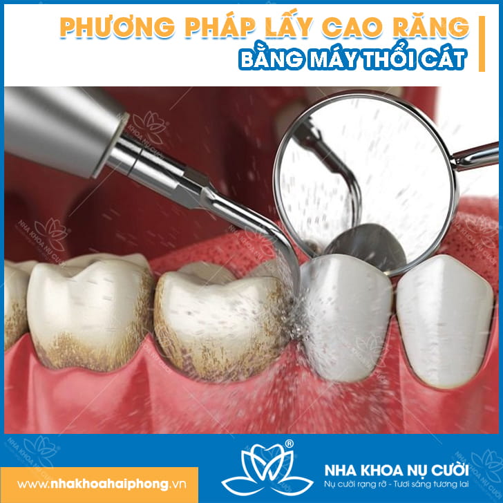 phuong-phap