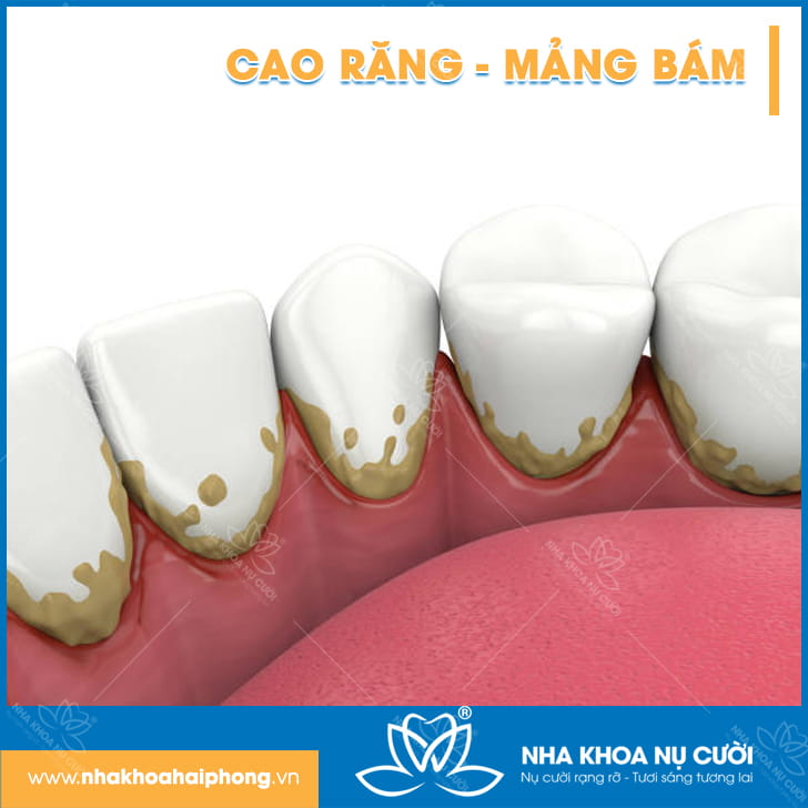 cao-rang-mang-bam