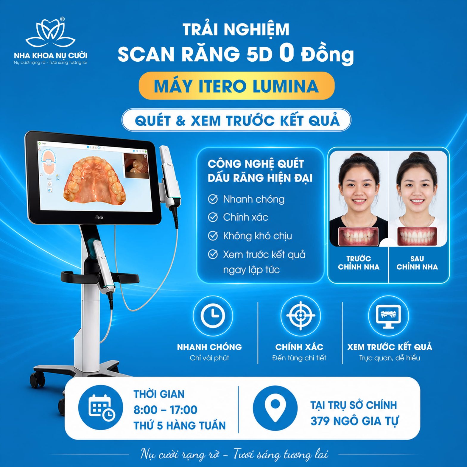 Trải Nghiệm Scan Răng 5D 0Đ Công Nghệ iTero Lumina