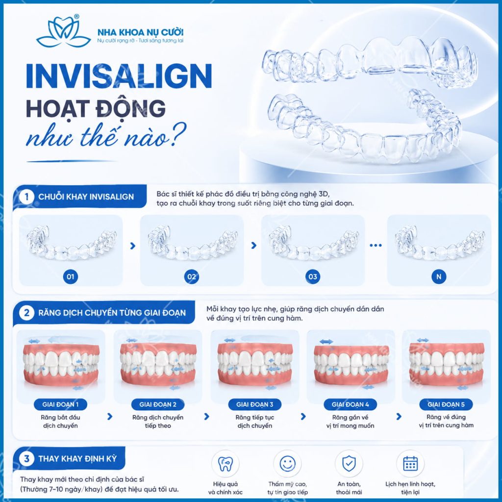 co-che-hoat-dong-cua-invisalign