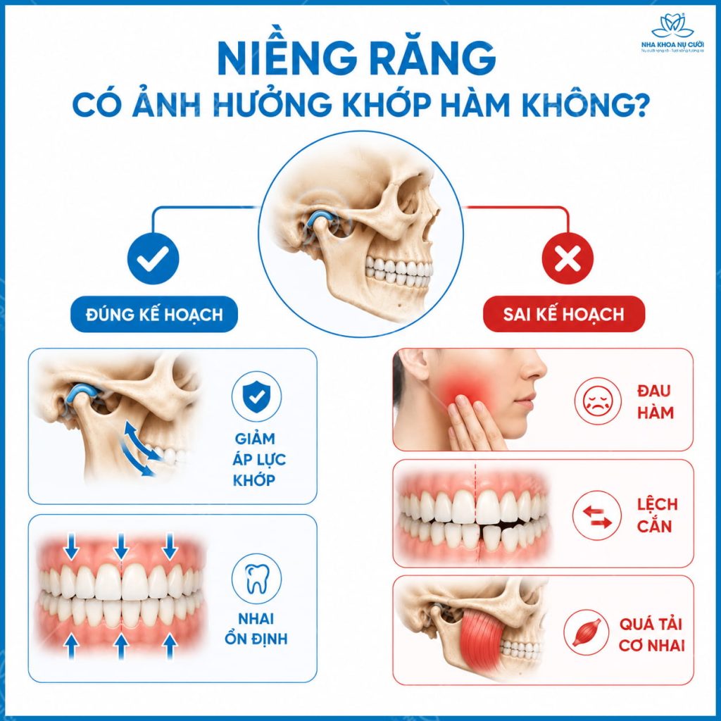 nieng-rang-khop-thai-duong-ham