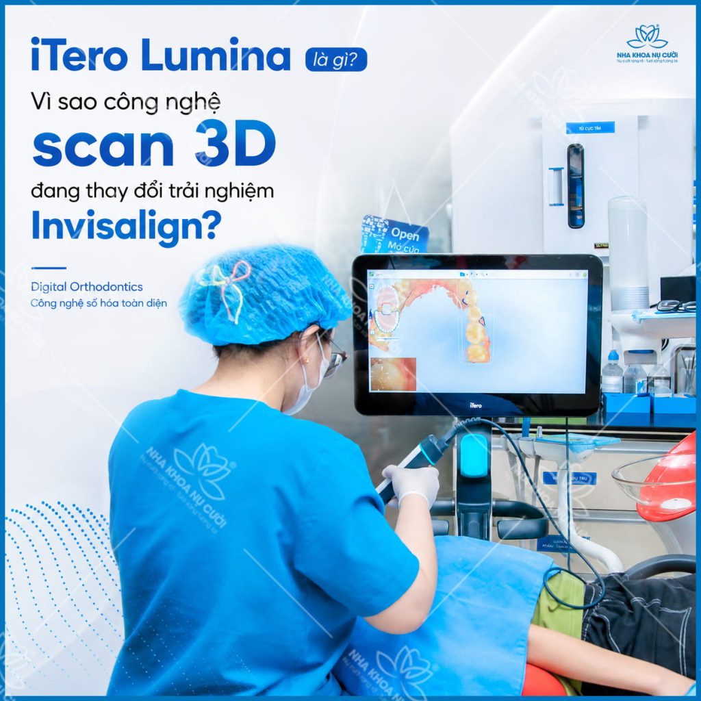 itero-lumina-scan-3d-hai-phong